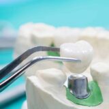 Canadian Dental Care Plan Renewal Dates (CDCP)
