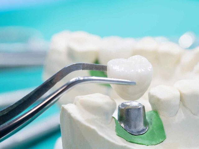 Canadian Dental Care Plan Renewal Dates (CDCP): What North York Patients Need to Know in 2026