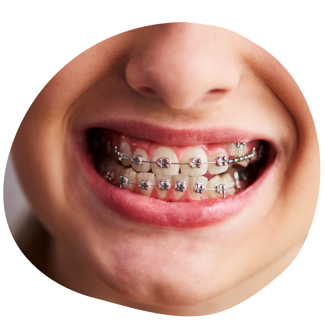 Orthodontics north york toronto
