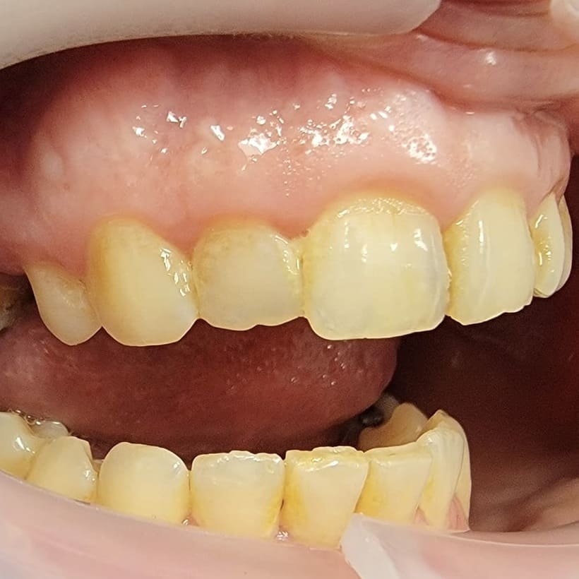 Laminate Composite north york