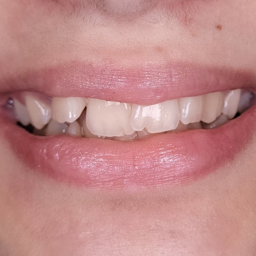 Orthodontics North York