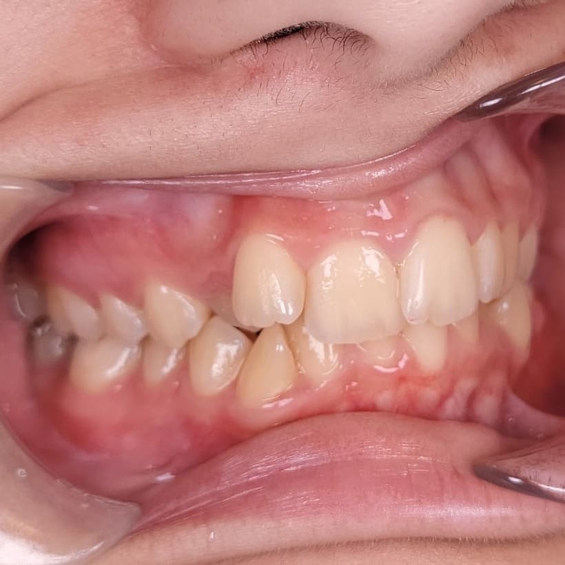 Orthodontics North York