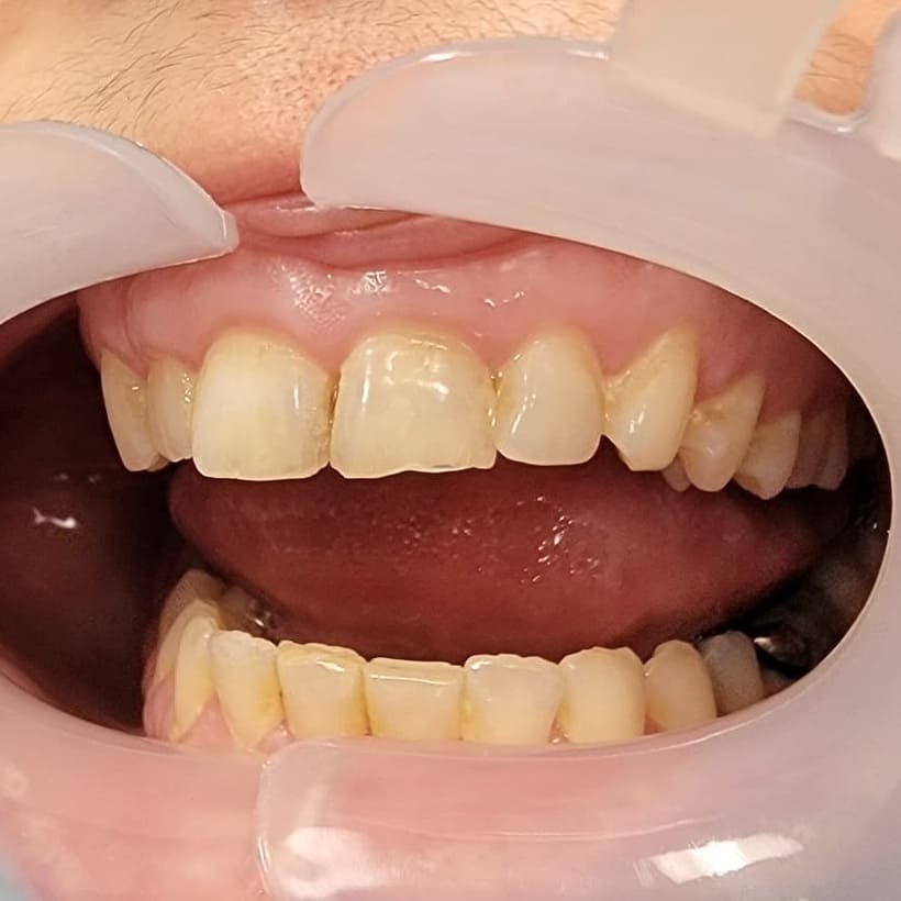 Laminate Composite north york